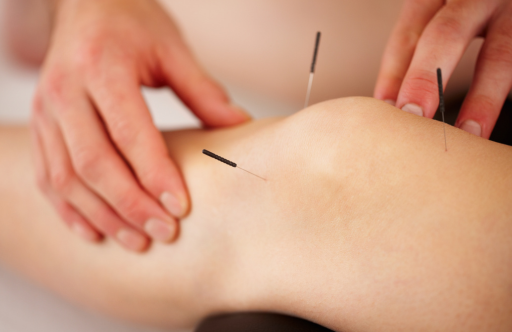 膝に鍼をしている